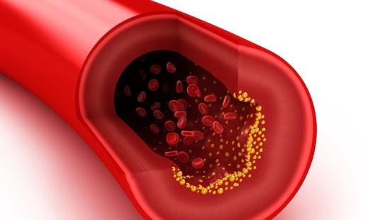 colesterol salud cardiovascular
